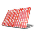 Harmony Hill - Apple MacBook Case