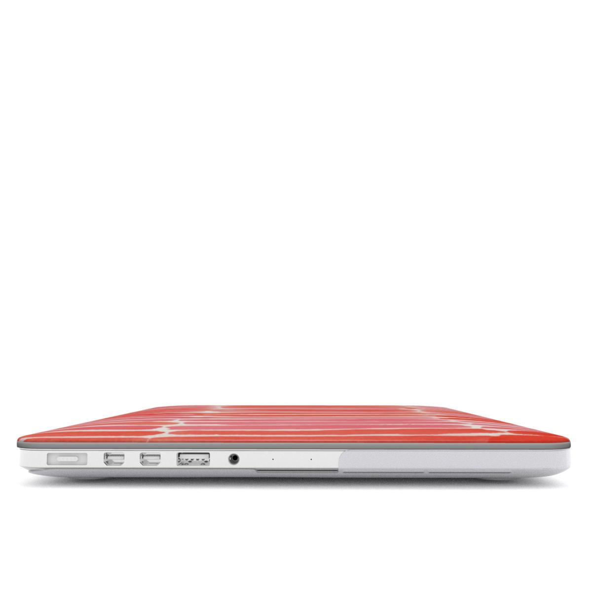 Harmony Hill - Apple MacBook Case