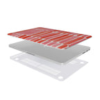 Harmony Hill - Apple MacBook Case